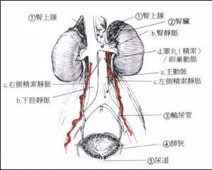 精索静脉曲张具体是什么疾病