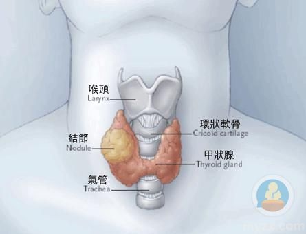 身患甲状腺炎的人群到底有多少知道这种疾病的具体危害是什么呢?