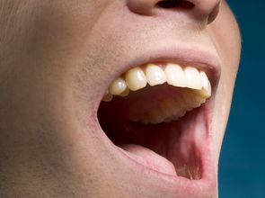 口腔癌的七大信号 口腔溃疡牙齿松动