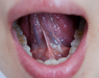 有很多的人平时喜欢看中医,在看中医的时候,中医往往会让伸出舌头