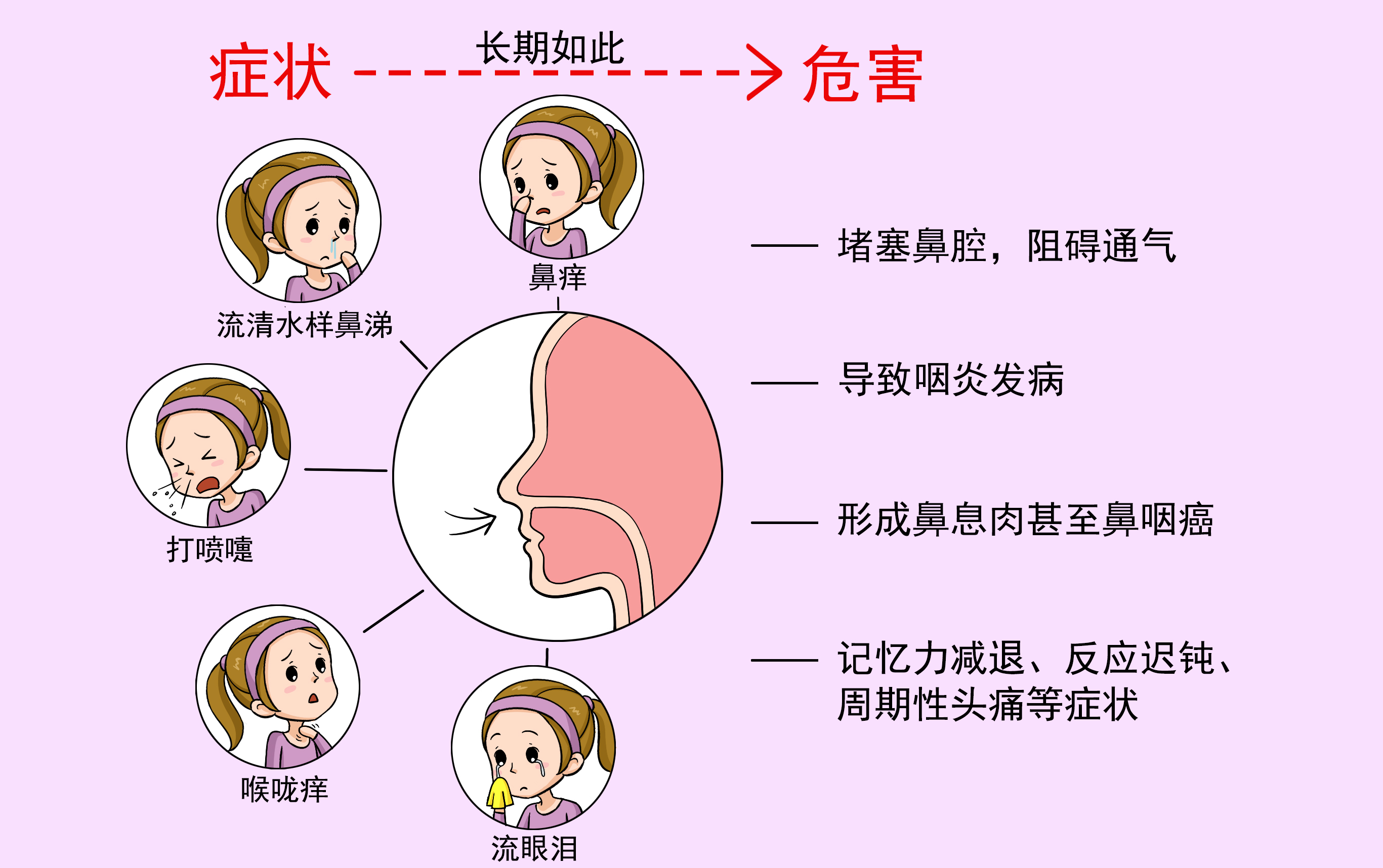 春季过敏性鼻炎高发，教您如何防治