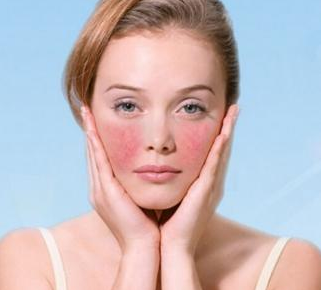 特别是过敏体质的人,脸上过敏和发红也比较多见,通常是因为脸部的细胞