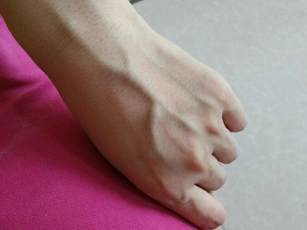 4,手掌中心青筋:预示肝胆功能疾病.手掌的生命线附