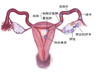 输卵管阻塞