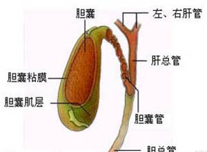 胆囊息肉