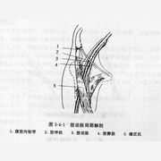 股动脉穿刺术