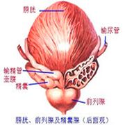 慢性前列腺炎