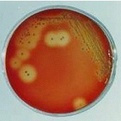 乙型溶血性链球菌