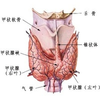 甲状腺结节钙化