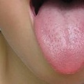 舌苔薄