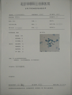 tct细胞学检查报告怎么看