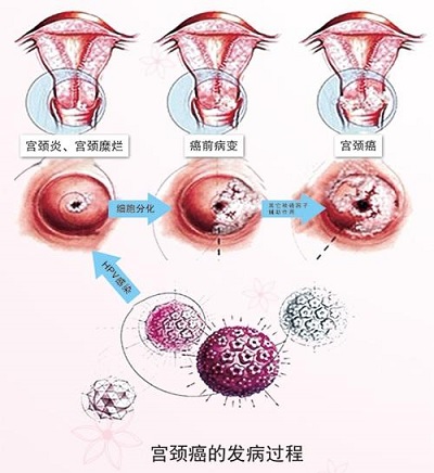 4,宫体,附件:在检查身体时要了解子宫的位置,形态,大小,质地,活动度.