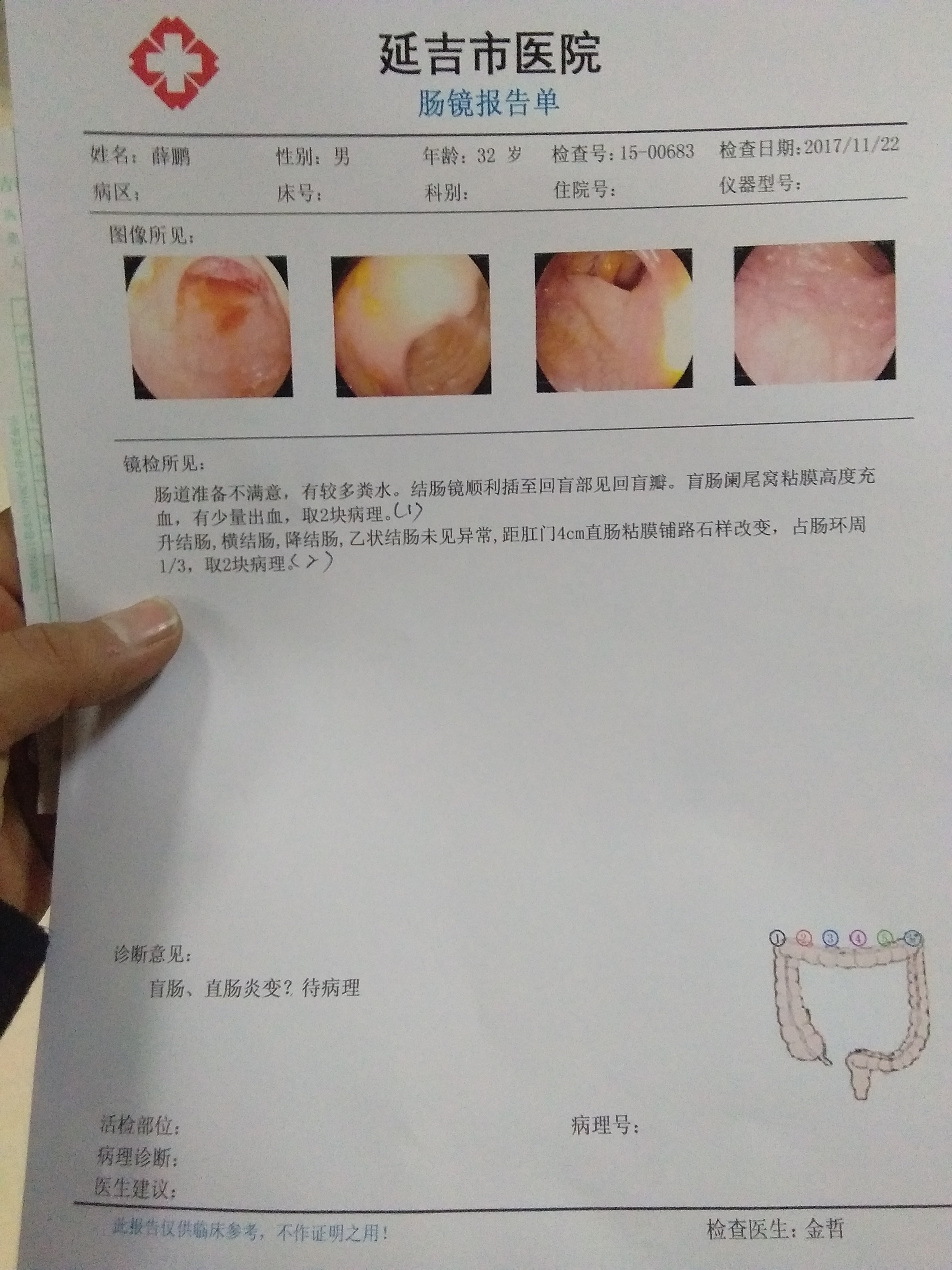 很长时间内一直大便很频繁,每天