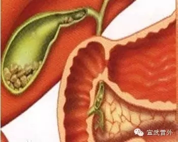 胆汁酸(盐)由胆固醇在肝内合成后随胆汁分泌至胆囊内储存并浓缩.