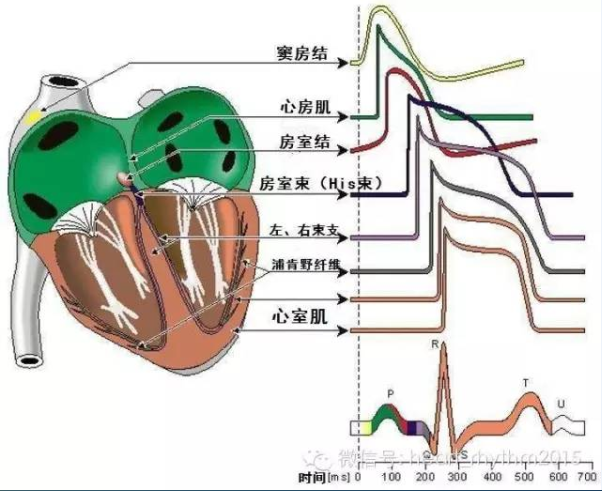 心脏电生理检查,心律失常界的"福尔摩斯"