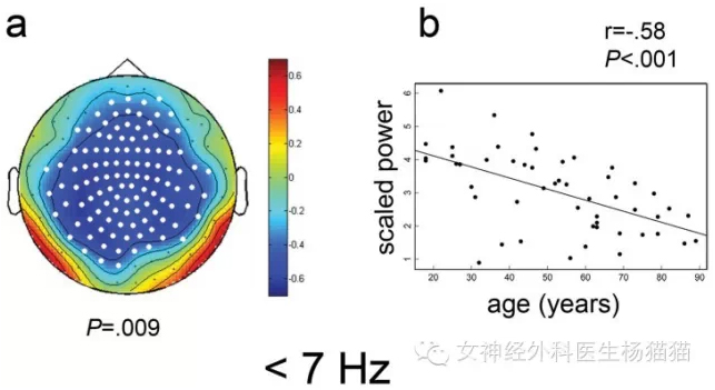 x-brain 第九课:基于脑电图和脑磁图的人脑复杂功能网络