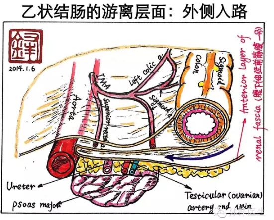 图(1):乙状结肠的解剖层面