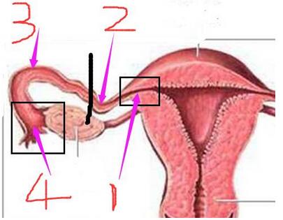 因此输卵管大致就分为这4部分: ①:间质部 ②:峡部 ③:壶腹部 ④