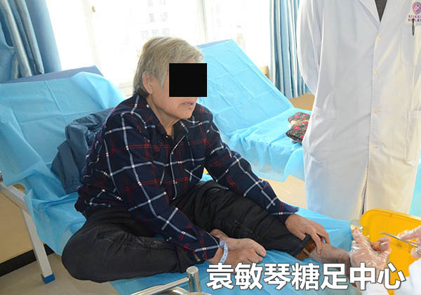 67糖尿病爛腳丫能不能治好啊