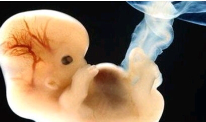 一个月的胎儿有多大图片