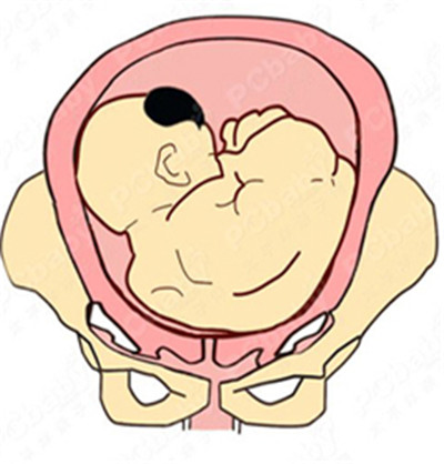 月份胎位图图片