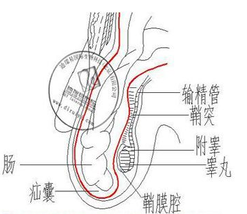 小儿疝气的诊断方法