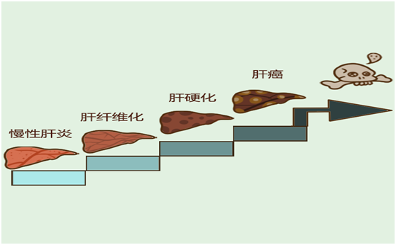 複方鱉甲軟肝片是不是抗纖維化,讓最新研究給你答案__尋醫問藥_xywy.