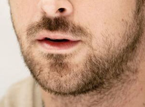 胡子泛指生长于男性上唇,下巴,面颊,两腮或脖子的