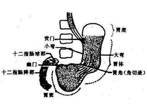 胃窦图片结构图图片