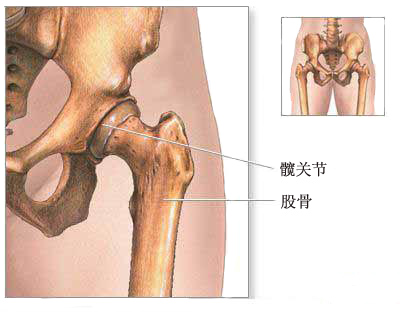 股骨头解剖位置图片