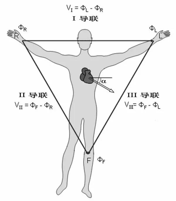 肢体导联(对应心电图的Ⅲ导)需要连接患者的左手,右手和左脚正