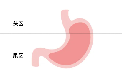 胃底的位置图片